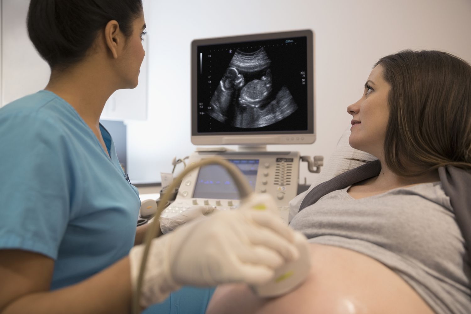 The Importance of Early Pregnancy Scans for Expectant Parents