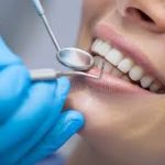 How to Find a Dentist That Truly Fits Your Needs